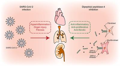 DPP-4 Inhibitors in the Prevention/Treatment of Pulmonary Fibrosis, Heart and Kidney Injury Caused by COVID-19—A Therapeutic Approach of Choice in Type 2 Diabetic Patients?